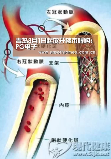 青岛8月1日起放开楼市限购:PG电子(图2) pg模拟器在线试玩